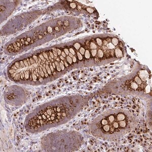 Merck Anti-RP11-111M22.2 antibody produced in rabbit