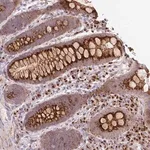 Merck Anti-RP11-111M22.2 antibody produced in rabbit