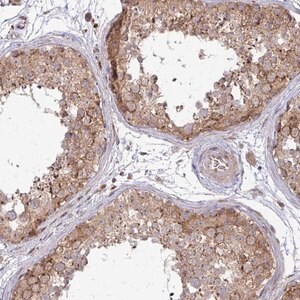 Merck Anti-TRIM44 antibody produced in rabbit