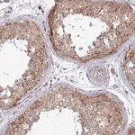 Merck Anti-TRIM44 antibody produced in rabbit