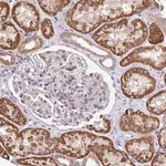 Merck Anti-TSPAN31 antibody produced in rabbit