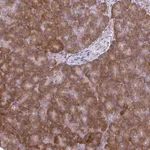 Merck Anti-CEMP1 antibody produced in rabbit