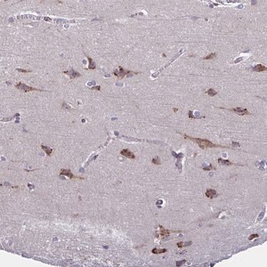 Merck Anti-C19orf35 antibody produced in rabbit