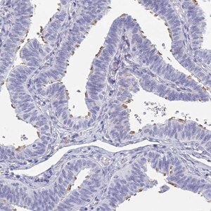 Merck Anti-MORN2 antibody produced in rabbit