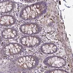 Merck Anti-BEND5 antibody produced in rabbit