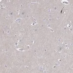 Merck Anti-CENPT antibody produced in rabbit