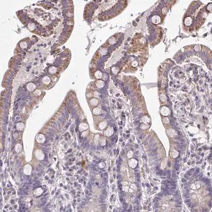 Merck Anti-CEP63 antibody produced in rabbit