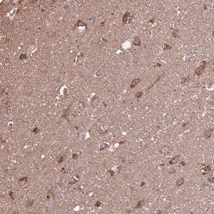 Merck Anti-ACOT6 antibody produced in rabbit