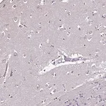 Merck Anti-CCDC85C antibody produced in rabbit