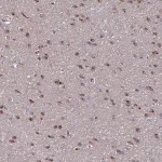 Merck Anti-NUMBL antibody produced in rabbit