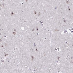 Merck Anti-CEP72 antibody produced in rabbit