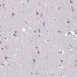 Merck Anti-CEP72 antibody produced in rabbit