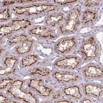 Merck Anti-TOR1AIP2 antibody produced in rabbit