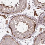 Merck Anti-LMNTD2 antibody produced in rabbit