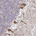 Merck Anti-HMBOX1 antibody produced in rabbit