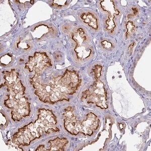 Merck Anti-ANKRD33 antibody produced in rabbit