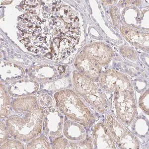 Merck Anti-PALM2-AKAP2 antibody produced in rabbit