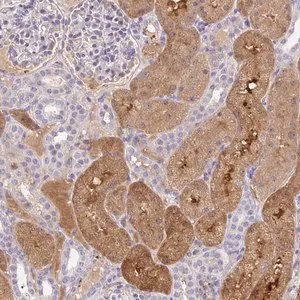 Merck Anti-ANO5 antibody produced in rabbit