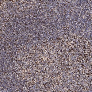 Merck Anti-ATAD3B antibody produced in rabbit