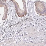 Merck Anti-RSRP1 antibody produced in rabbit