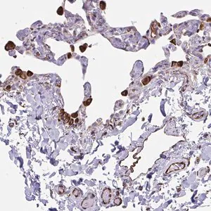 Merck Anti-CACNG3 antibody produced in rabbit