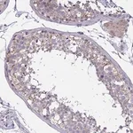 Merck Anti-TCEAL8 antibody produced in rabbit