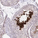 Merck Anti-FUNDC2 antibody produced in rabbit