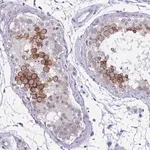 Merck Anti-NFXL1 antibody produced in rabbit