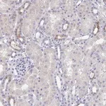 Merck Anti-KCNK5 antibody produced in rabbit
