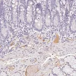 Merck Anti-ITIH2 antibody produced in rabbit
