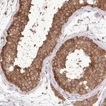 Merck Anti-C12orf57 antibody produced in rabbit