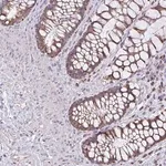 Merck Anti-ZNF362 antibody produced in rabbit