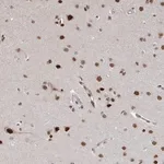 Merck Anti-ZDHHC12 antibody produced in rabbit