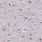 Merck Anti-ASPH antibody produced in rabbit