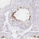 Merck Anti-VWC2L antibody produced in rabbit