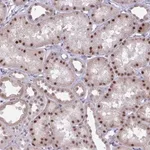 Merck Anti-PRMT6 antibody produced in rabbit