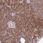 Merck Anti-HOXD12 antibody produced in rabbit