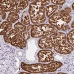 Merck Anti-UGT3A2 antibody produced in rabbit