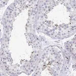 Merck Anti-MROH2B antibody produced in rabbit