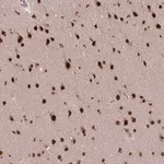 Merck Anti-SS18 antibody produced in rabbit