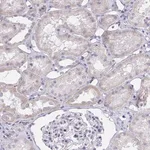 Merck Anti-ZNF182 antibody produced in rabbit