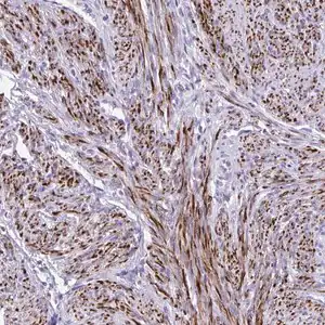 Merck Anti-KCNN4 antibody produced in rabbit