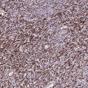 Merck Anti-ZNF559 antibody produced in rabbit