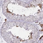 Merck Anti-ZNF784 antibody produced in rabbit