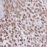 Merck Anti-DCBLD1 antibody produced in rabbit