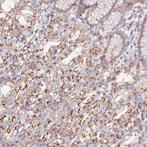 Merck Anti-DISP2 antibody produced in rabbit