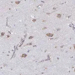 Merck Anti-TMEM241 antibody produced in rabbit