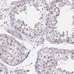 Merck Anti-ANKRD62 antibody produced in rabbit