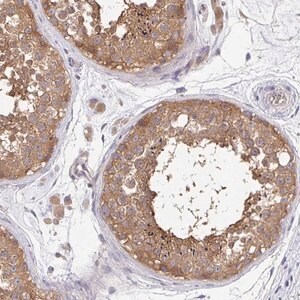 Merck Anti-FEM1C antibody produced in rabbit