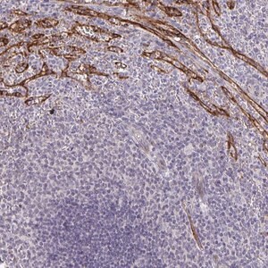 Merck Anti-TMEM82 antibody produced in rabbit
